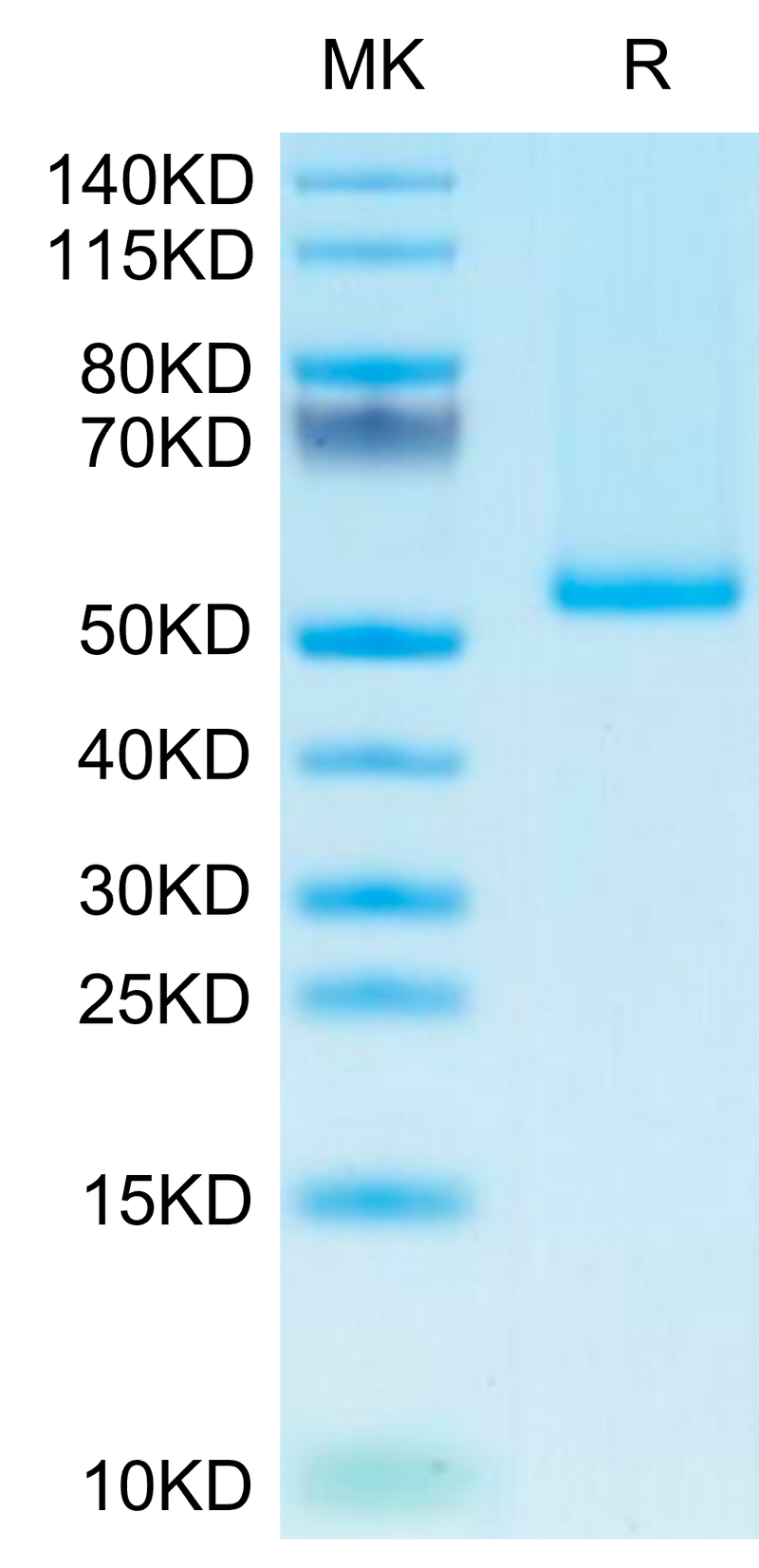 Human 4‑1BB Ligand Trimer on Tris-Bis PAGE under reduced condition. The purity is greater than 95%.