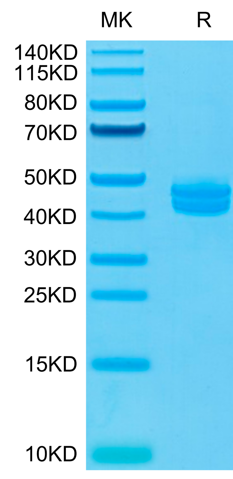 Cynomolgus CD3E&CD3G on Tris-Bis PAGE under reduced conditions. The purity is greater than 95%.