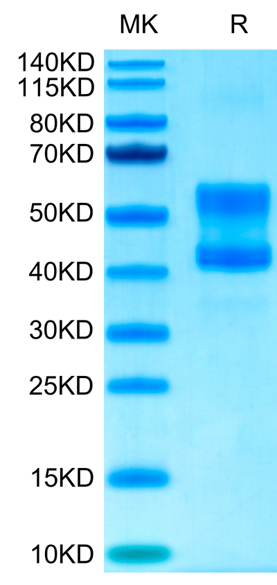 Cynomolgus CD3E&CD3D on Tris-Bis PAGE under reduced conditions. The purity is greater than 95%.