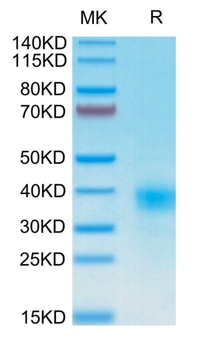 Human CD94 on Tris-Bis PAGE under reduced condition. The purity is greater than 95%.