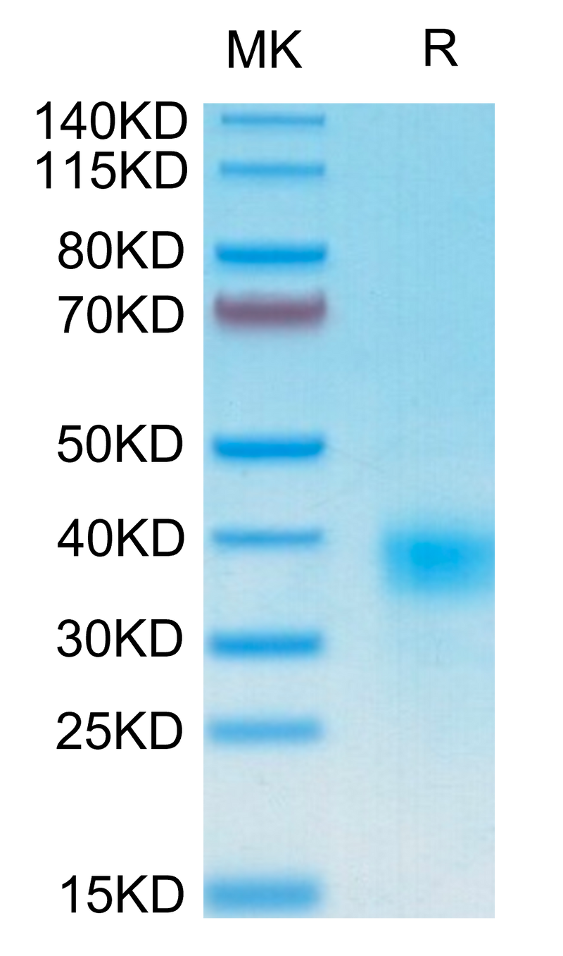 Human CD94 on Tris-Bis PAGE under reduced condition. The purity is greater than 95%.