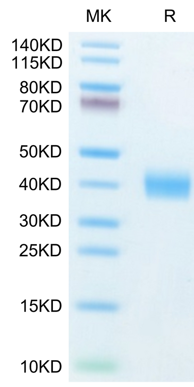 Human Galectin 3 on Tris-Bis PAGE under reduced condition. The purity is greater than 95%.