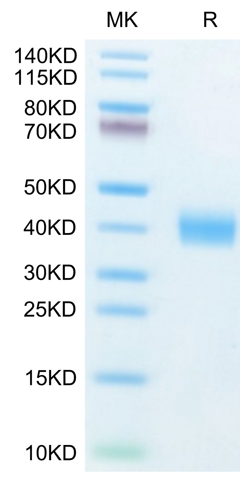 Human Galectin 3 on Tris-Bis PAGE under reduced condition. The purity is greater than 95%.