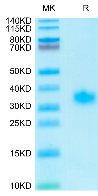 Human Adiponectin on Tris-Bis PAGE under reduced condition. The purity is greater than 95%.