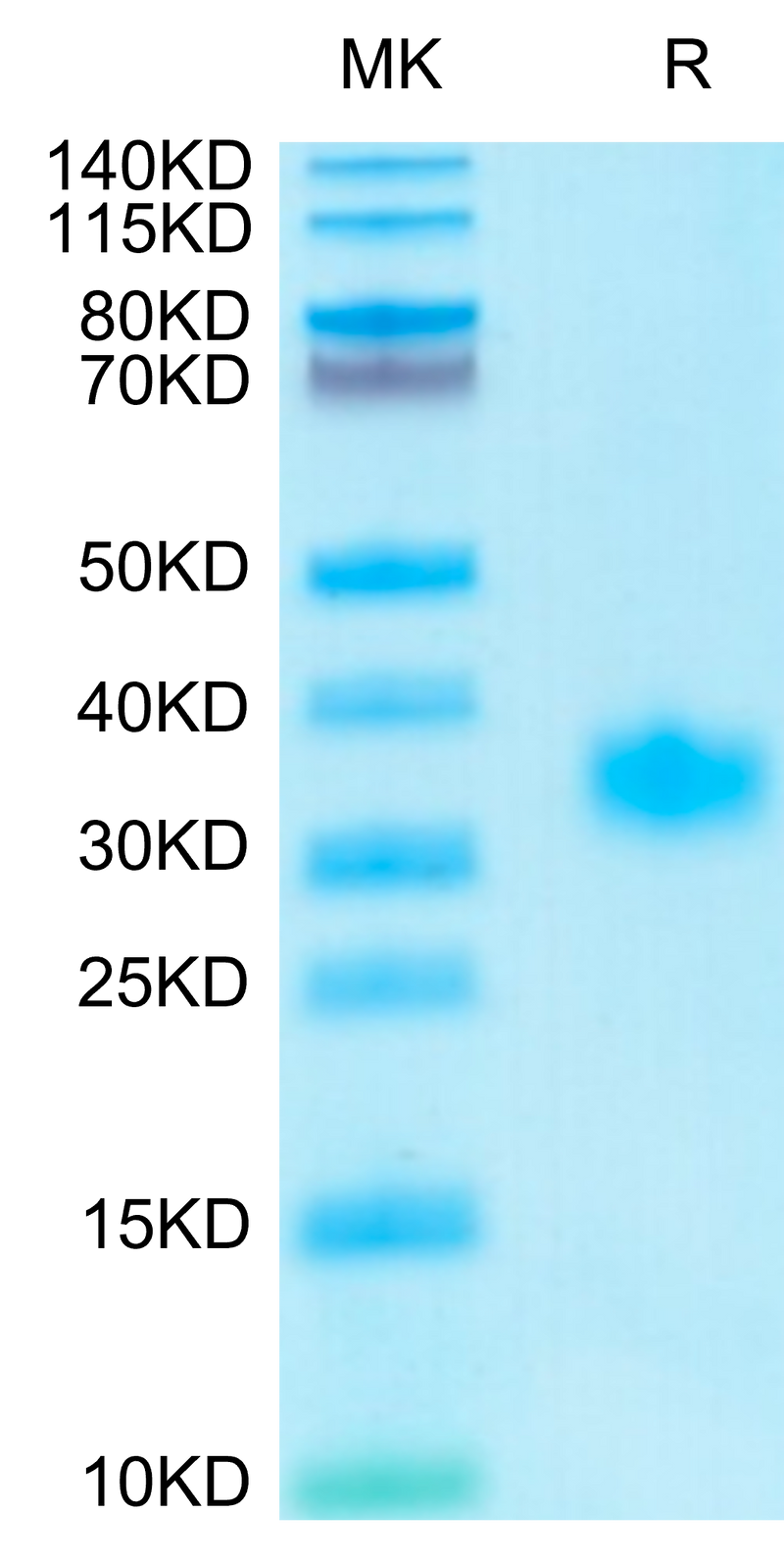 Human Adiponectin on Tris-Bis PAGE under reduced condition. The purity is greater than 95%.