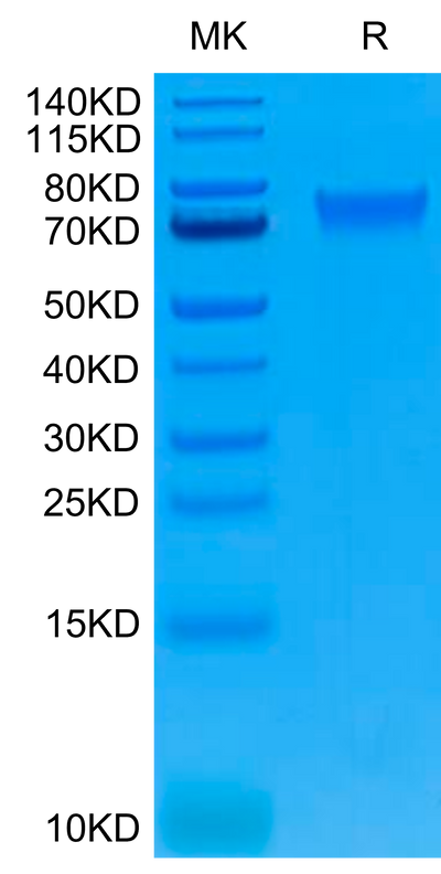 Human IL-6 R alpha on Tris-Bis PAGE under reduced conditions. The purity is greater than 95%.