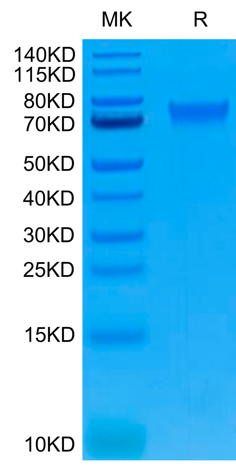 Human IL-6 R alpha on Tris-Bis PAGE under reduced conditions. The purity is greater than 95%.