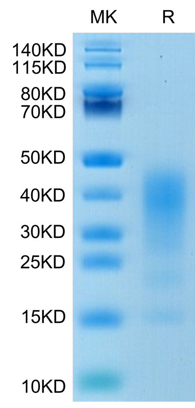 Human IL-13 on Tris-Bis PAGE under reduced condition. The purity is greater than 90%.