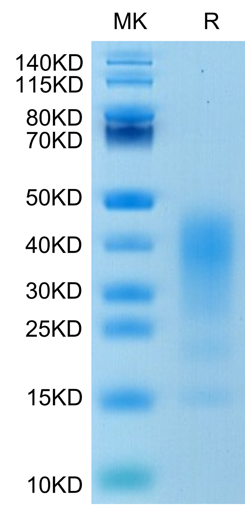 Human IL-13 on Tris-Bis PAGE under reduced condition. The purity is greater than 90%.