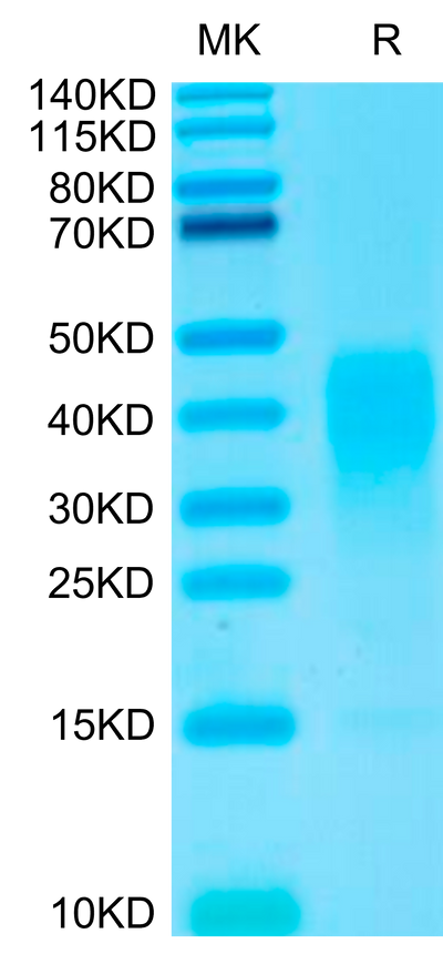 Biotinylated IL-13 on Tris-Bis PAGE under reduced conditions. The purity is greater than 90%.