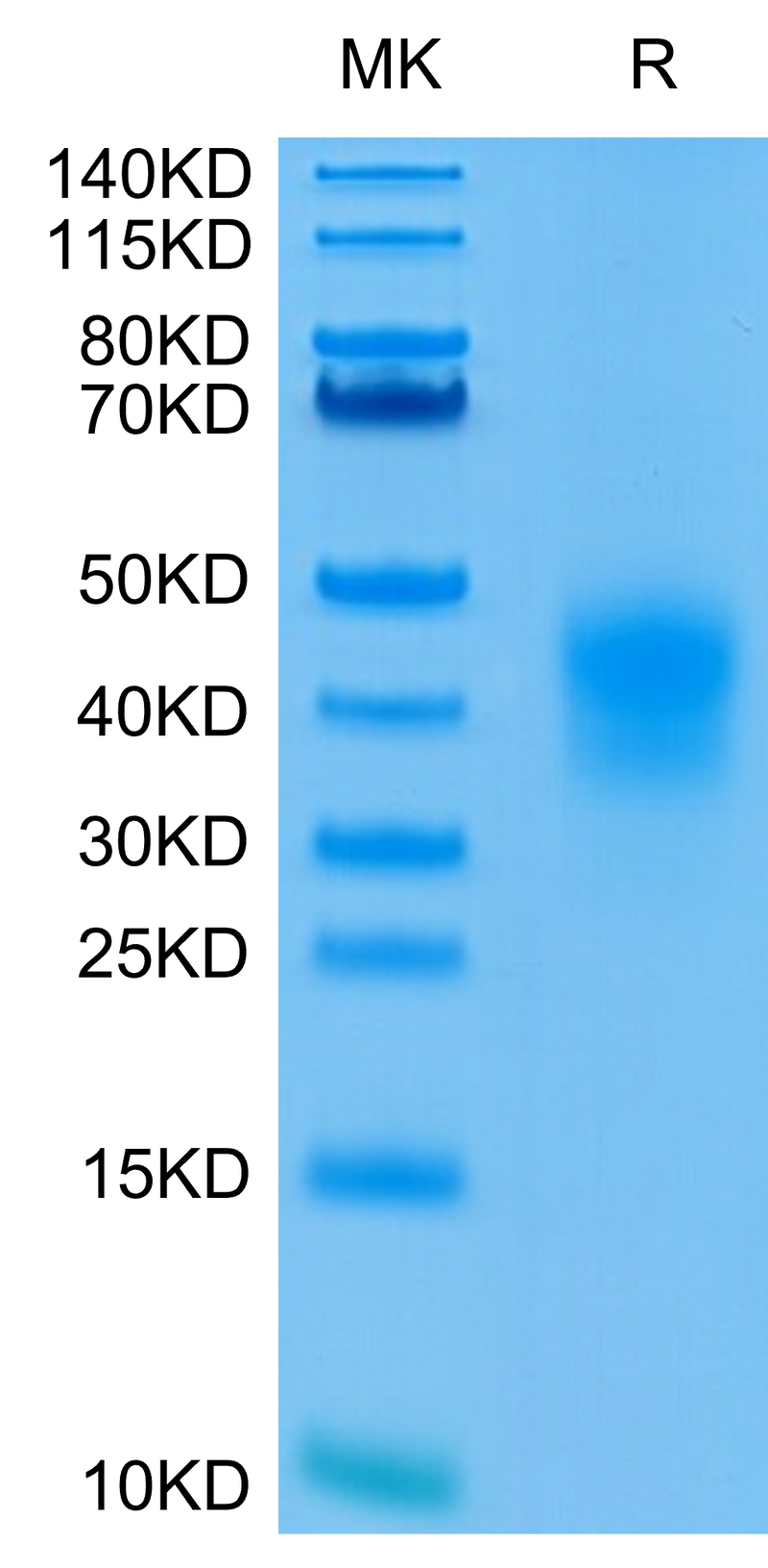 Human CD79B on Tris-Bis PAGE under reduced condition. The purity is greater than 95%.