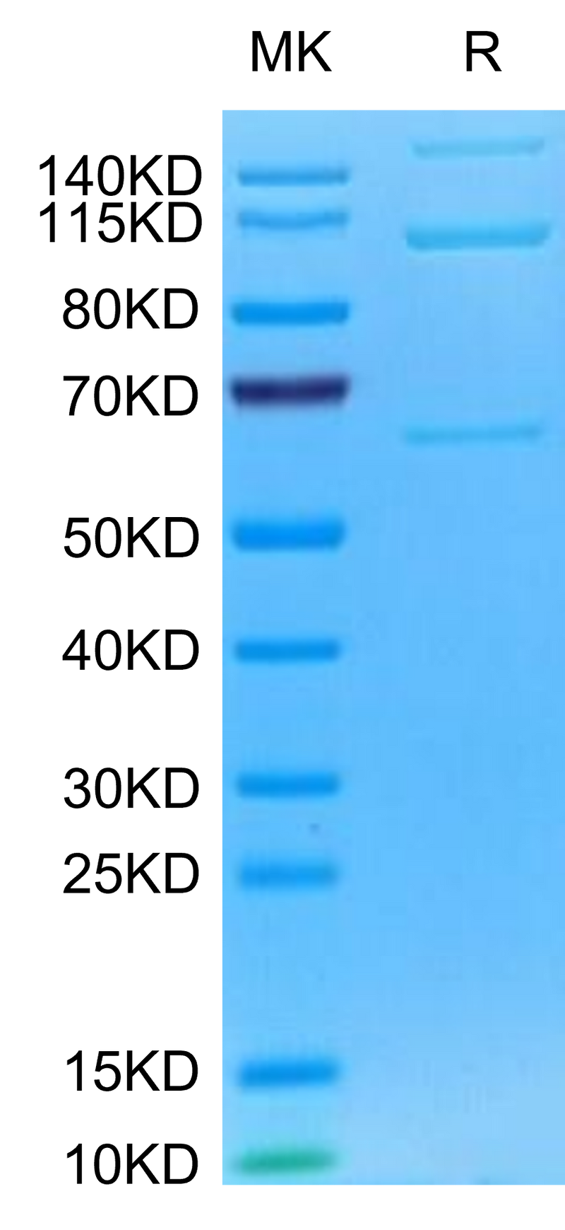 Mouse Complement component 3 on Tris-Bis PAGE under reduced condition. The purity is greater than 95%.