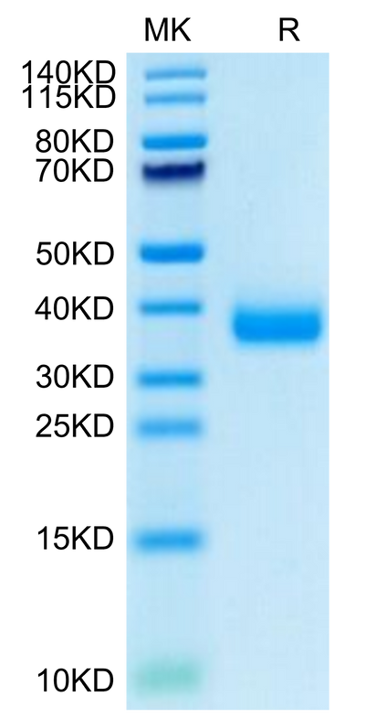 SARS-COV-2 Spike RBD (Omicron B.1.1.529) on Tris-Bis PAGE under reduced condition. The purity is greater than 95%.