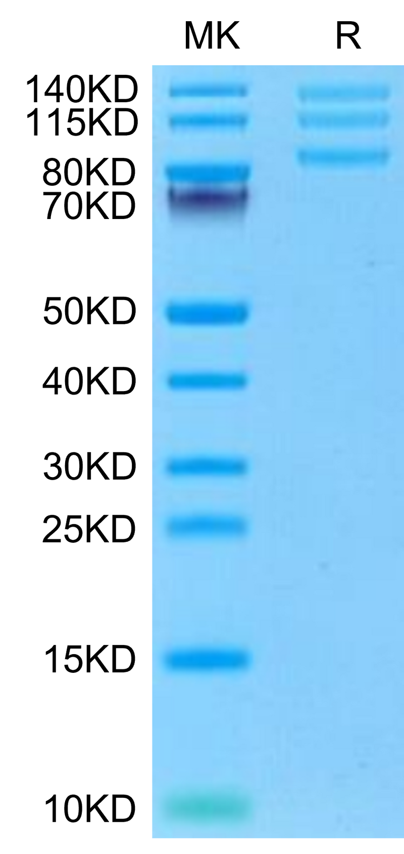 Rhesus macaque ITGAV&ITGB8 on Tris-Bis PAGE under reduced condition. The purity is greater than 95%.