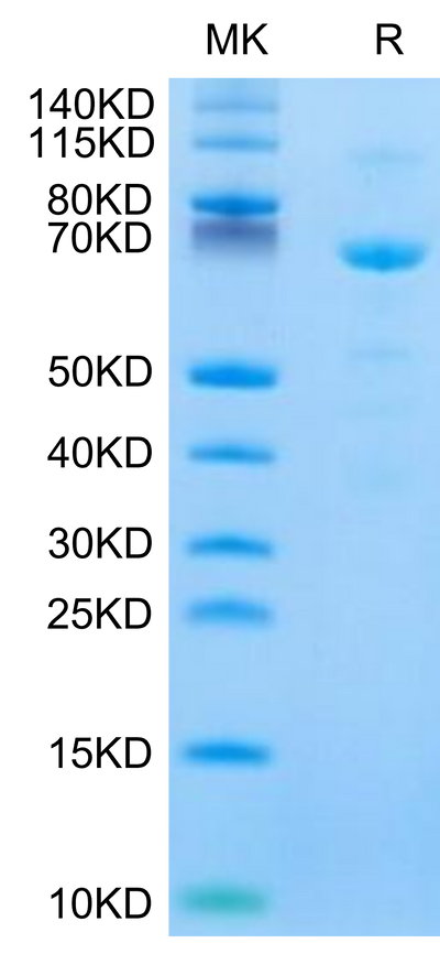 Human CDH11 on Tris-Bis PAGE under reduced condition. The purity is greater than 90%.