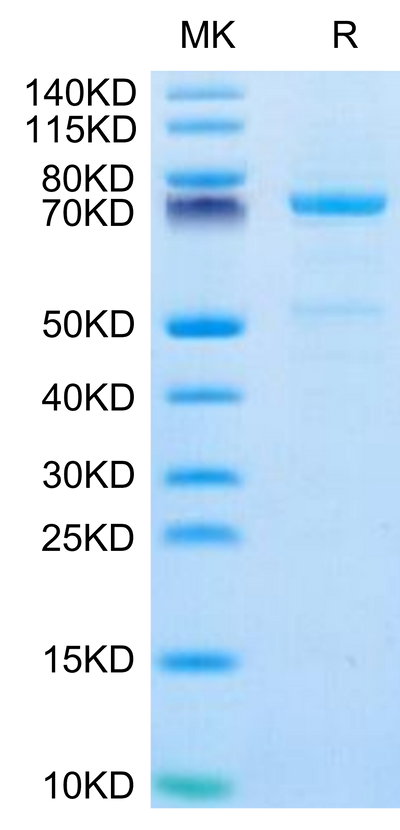 Human CDH3 on Tris-Bis PAGE under reduced condition. The purity is greater than 95%.