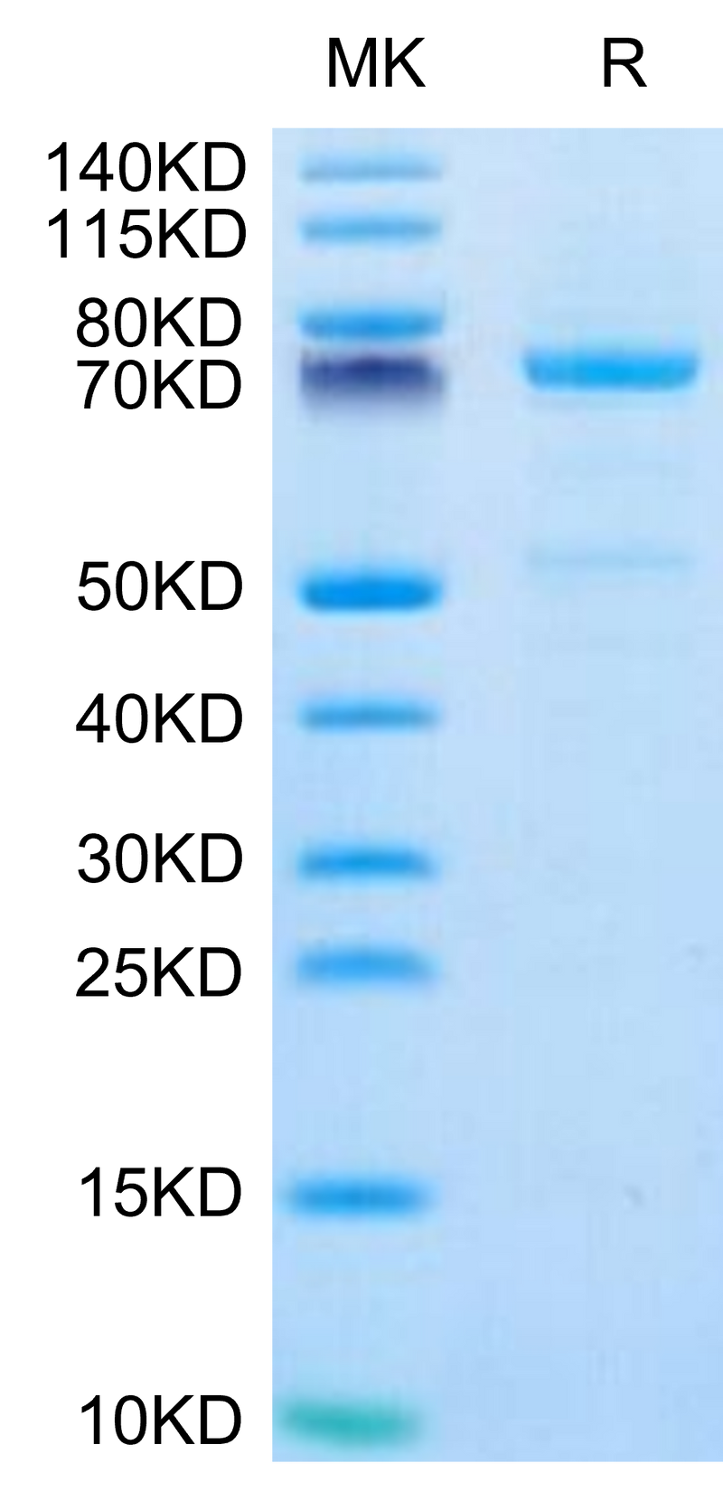 Human CDH3 on Tris-Bis PAGE under reduced condition. The purity is greater than 95%.