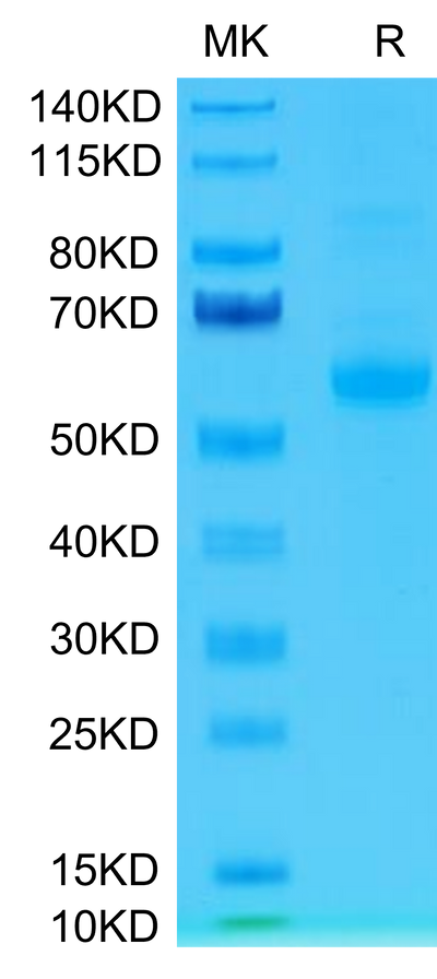 Human Siglec-15 on Tris-Bis PAGE under reduced condition. The purity is greater than 95%.