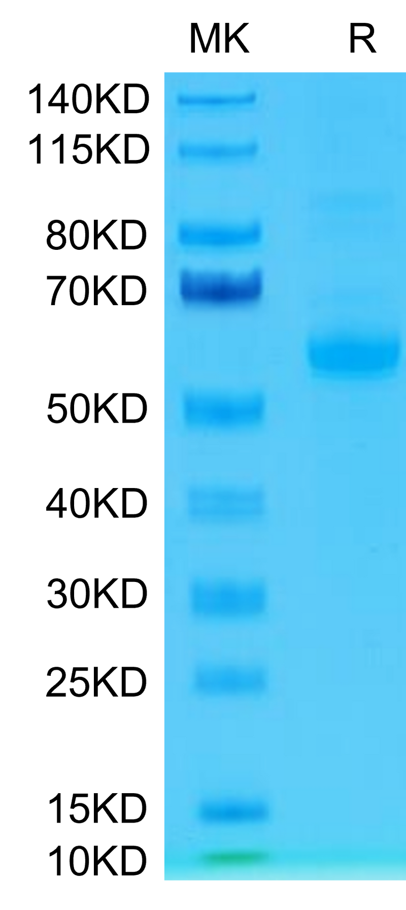 Human Siglec-15 on Tris-Bis PAGE under reduced condition. The purity is greater than 95%.