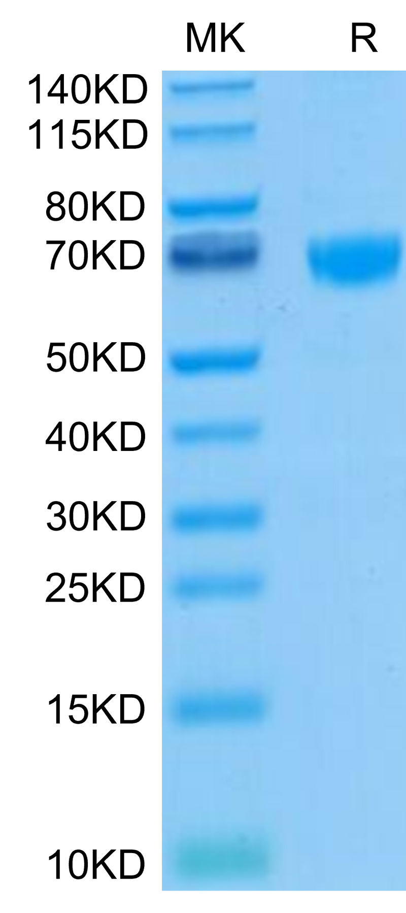 Biotinylated Human PD-1 on Tris-Bis PAGE under reduced. The purity is greater than 95%.