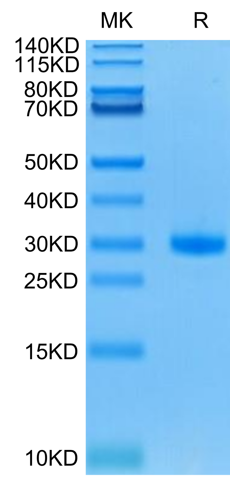 Mouse CD40 on Tris-Bis PAGE under reduced condition. The purity is greater than 95%.