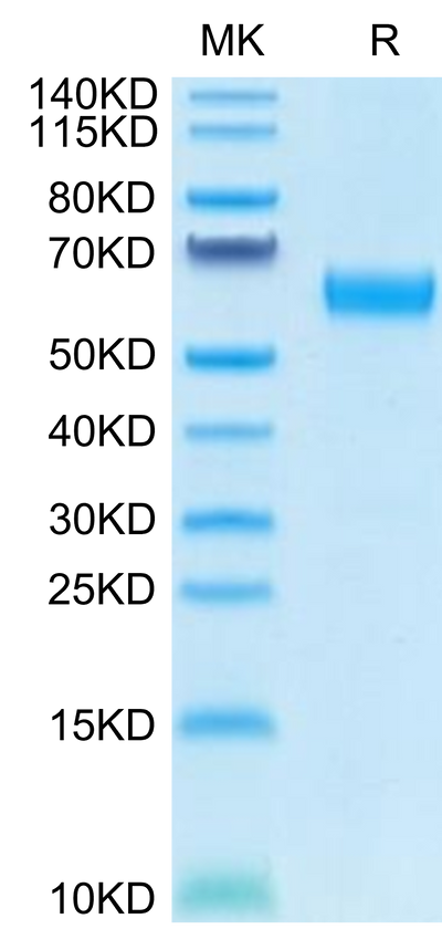 Human CD47 on Tris-Bis PAGE under reduced condition. The purity is greater than 95%.