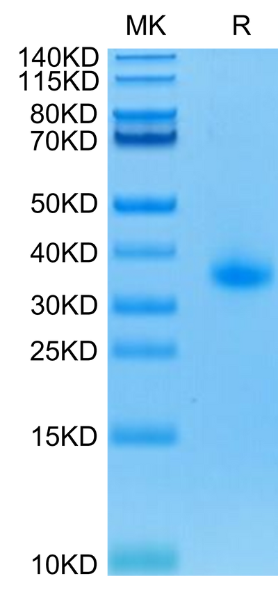 Human CD40 on Tris-Bis PAGE under reduced condition. The purity is greater than 95%.