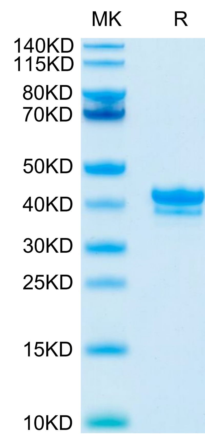 Cynomolgus/Rhesus macaque BCMA on Tris-Bis PAGE under reduced condition. The purity is greater than 95%.