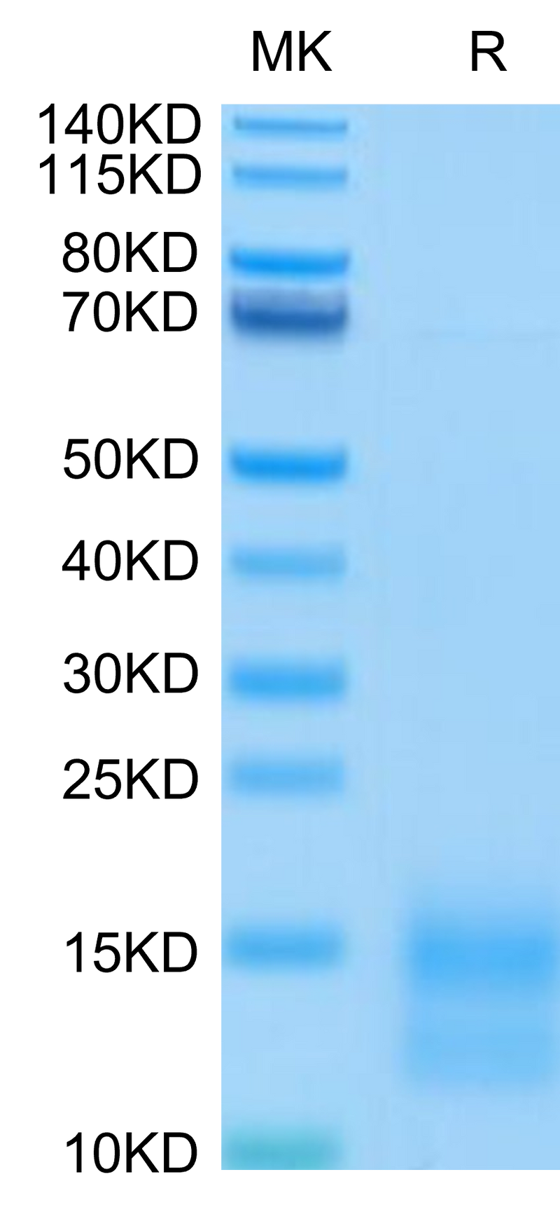 Mouse BCMA on Tris-Bis PAGE under reduced condition. The purity is greater than 95%.