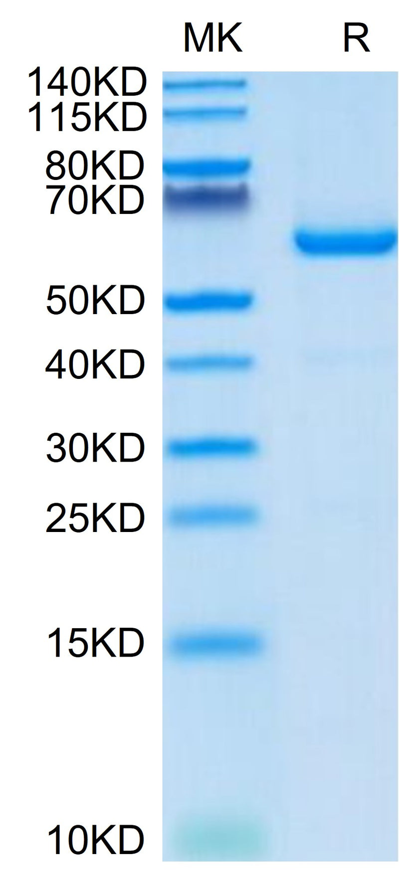 Mouse CD73 on Tris-Bis PAGE under reduced condition. The purity is greater than 95%.