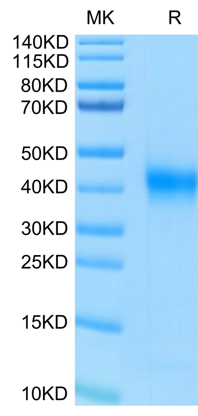 Human FOLR1 on Tris-Bis PAGE under reduced condition. The purity is greater than 95%.