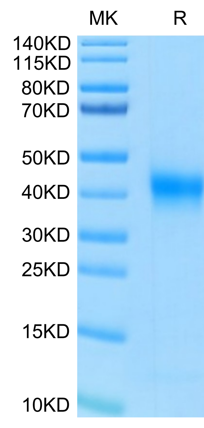 Human FOLR1 on Tris-Bis PAGE under reduced condition. The purity is greater than 95%.