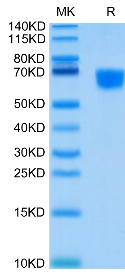 Human CD30 Ligand on Tris-Bis PAGE under reduced condition. The purity is greater than 95%.