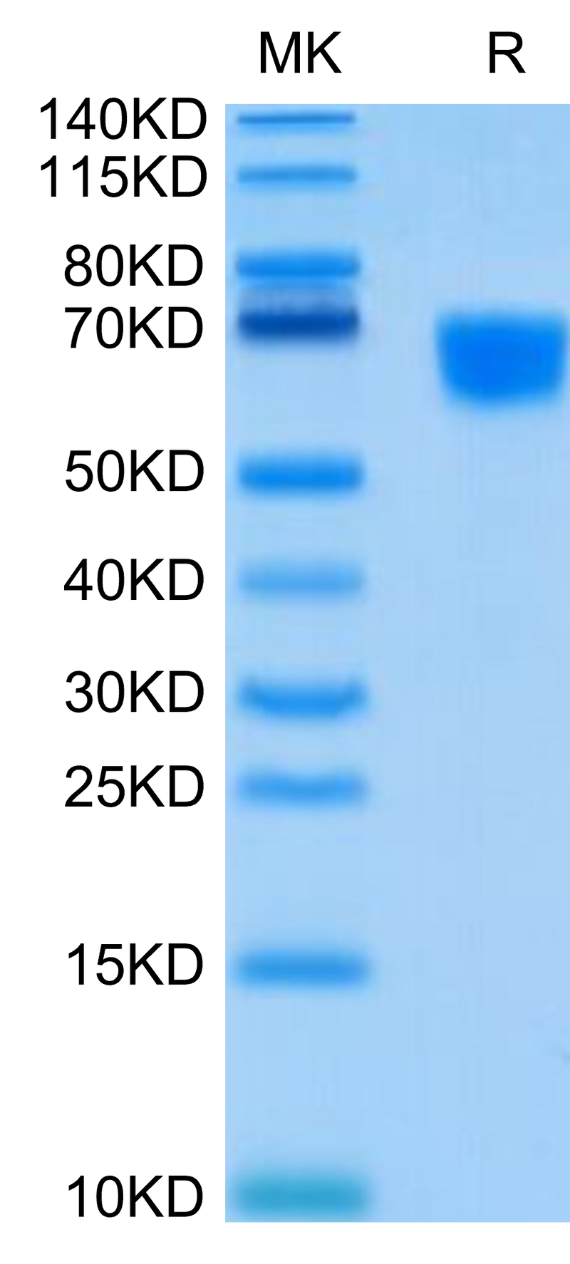 Human CD30 Ligand on Tris-Bis PAGE under reduced condition. The purity is greater than 95%.