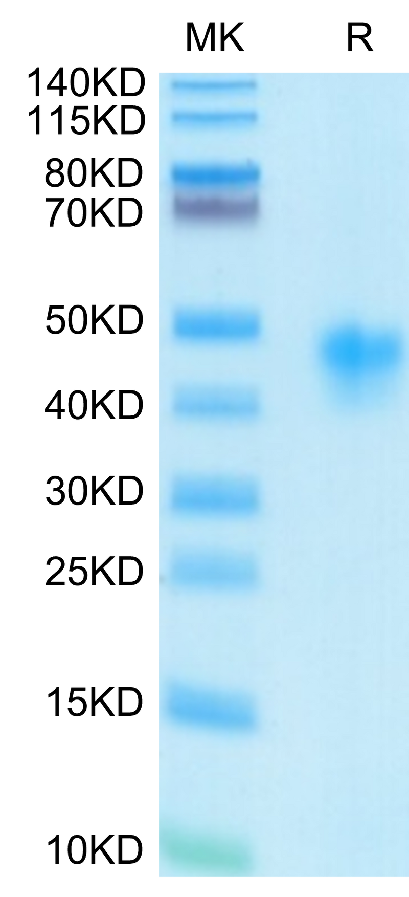 Human IL-2 R alpha on Tris-Bis PAGE under reduced condition. The purity is greater than 95%.