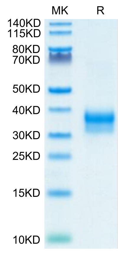 Mouse Siglec-15 on Tris-Bis PAGE under reduced condition. The purity is greater than 95%.