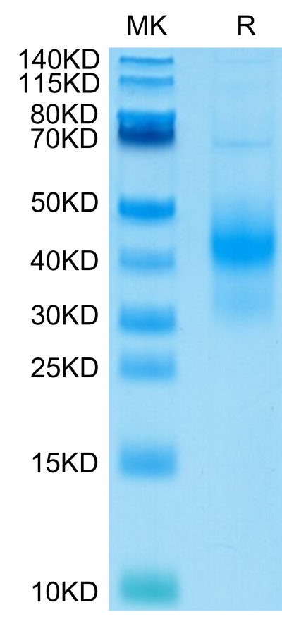 Human NKG2D on Tris-Bis PAGE under reduced condition. The purity is greater than 95%.