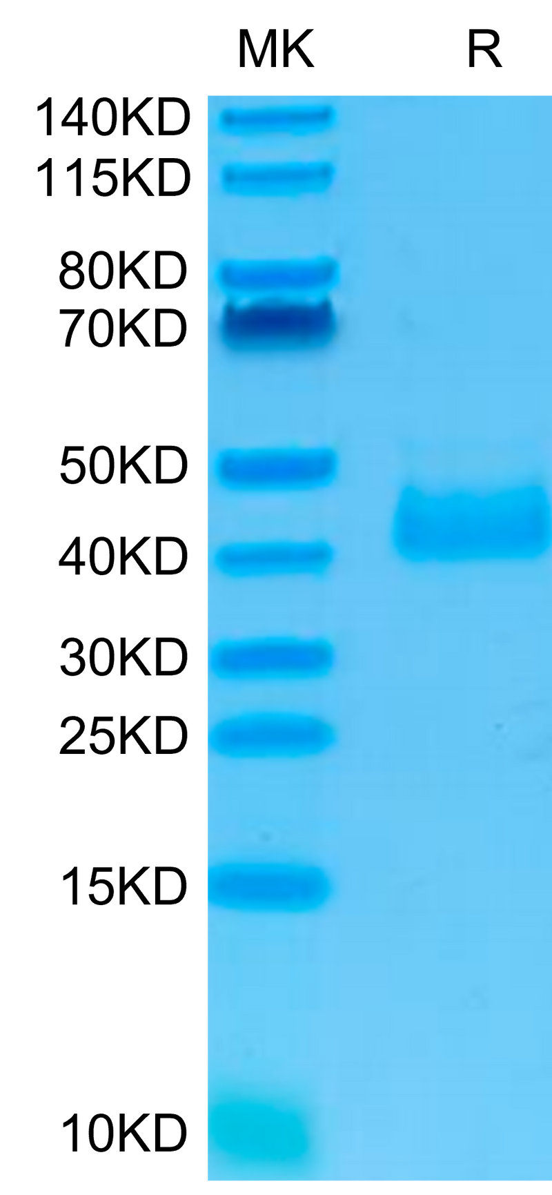 Human NKp46 on Tris-Bis PAGE under reduced condition. The purity is greater than 95%.