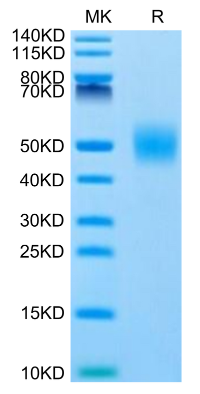 Human FGFR1 beta (IIIc) on Tris-Bis PAGE under reduced condition. The purity is greater than 95%.