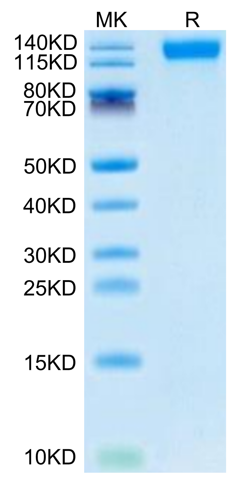 SARS-COV-2 Spike S1 (Omicron B.1.1.529) on Tris-Bis PAGE under reduced condition. The purity is greater than 95%.