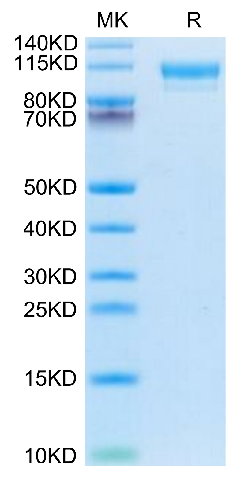 Mouse CD9P1 on Tris-Bis PAGE under reduced condition. The purity is greater than 95%.