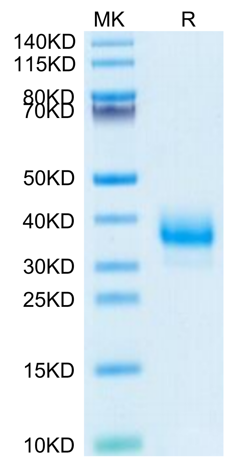 Cynomolgus Fc gamma RIIB on Tris-Bis PAGE under reduced condition. The purity is greater than 95%.