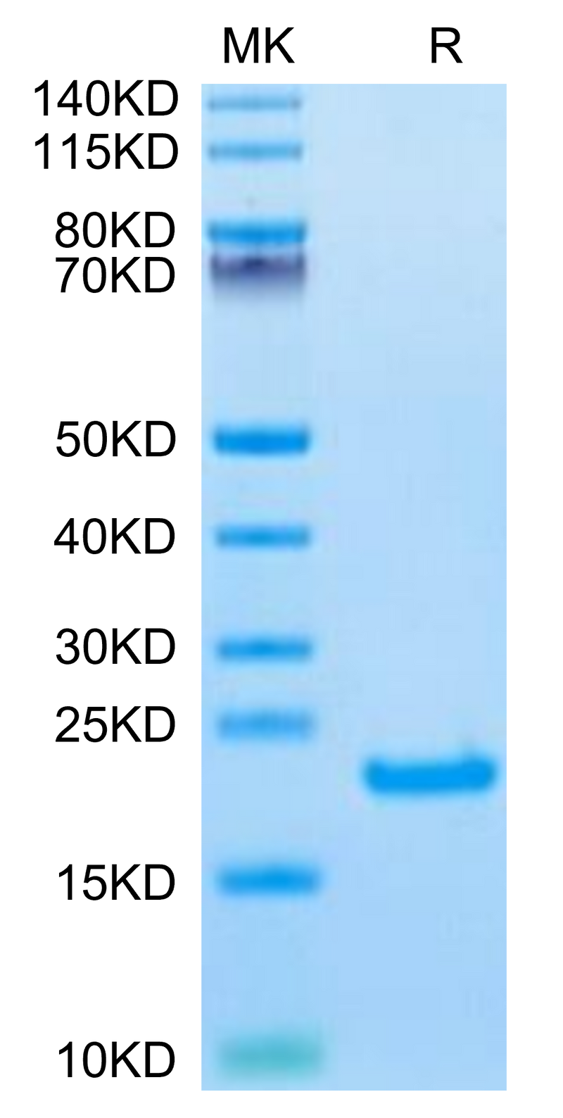 Biotinylated Human IL-21 on Tris-Bis PAGE under reduced condition. The purity is greater than 95%.