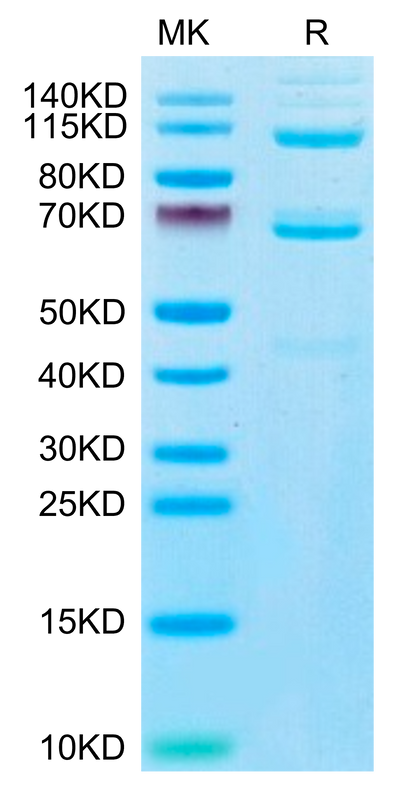 Human Complement component 3 on Tris-Bis PAGE under reduced condition. The purity is greater than 95%.