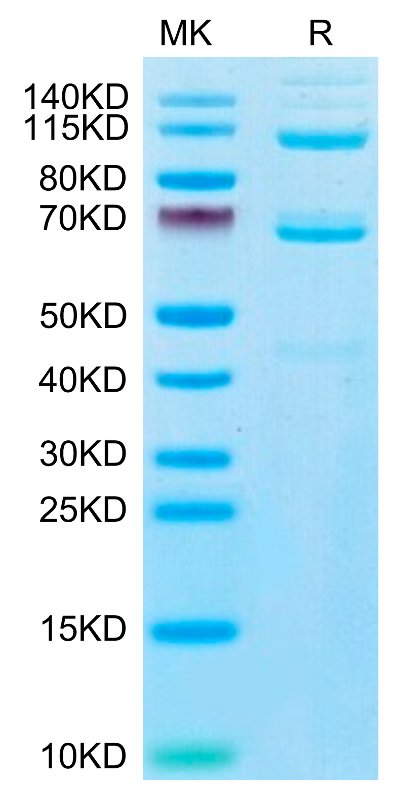 Human Complement component 3 on Tris-Bis PAGE under reduced condition. The purity is greater than 95%.