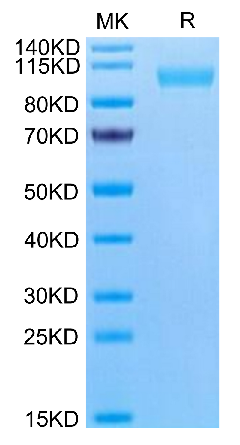 Human CD9P1 on Tris-Bis PAGE under reduced condition. The purity is greater than 95%.