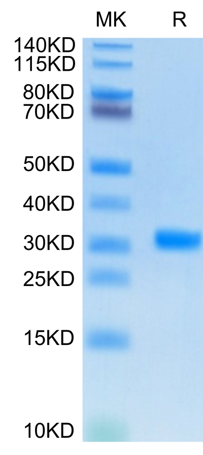 SARS-CoV-2 3CLpro on Tris-Bis PAGE under reduced condition. The purity is greater than 95%.