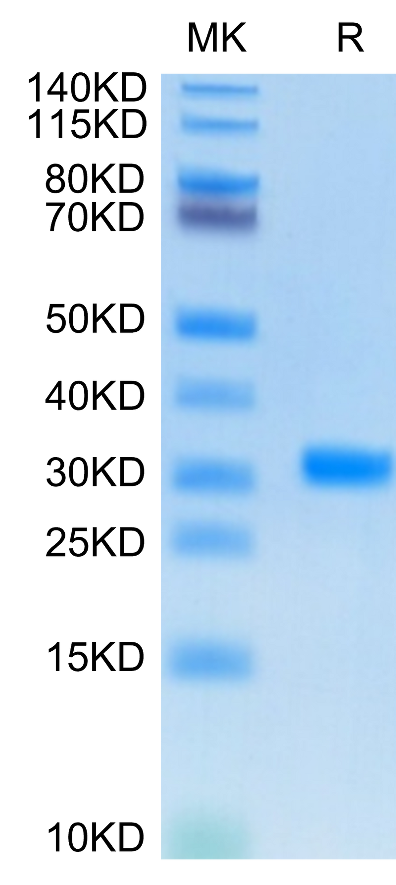 SARS-CoV-2 3CLpro on Tris-Bis PAGE under reduced condition. The purity is greater than 95%.