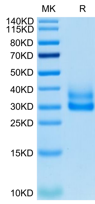 Cynomolgus/Rhesus macaque 4-1BB on Tris-Bis PAGE under reduced condition. The purity is greater than 95%.