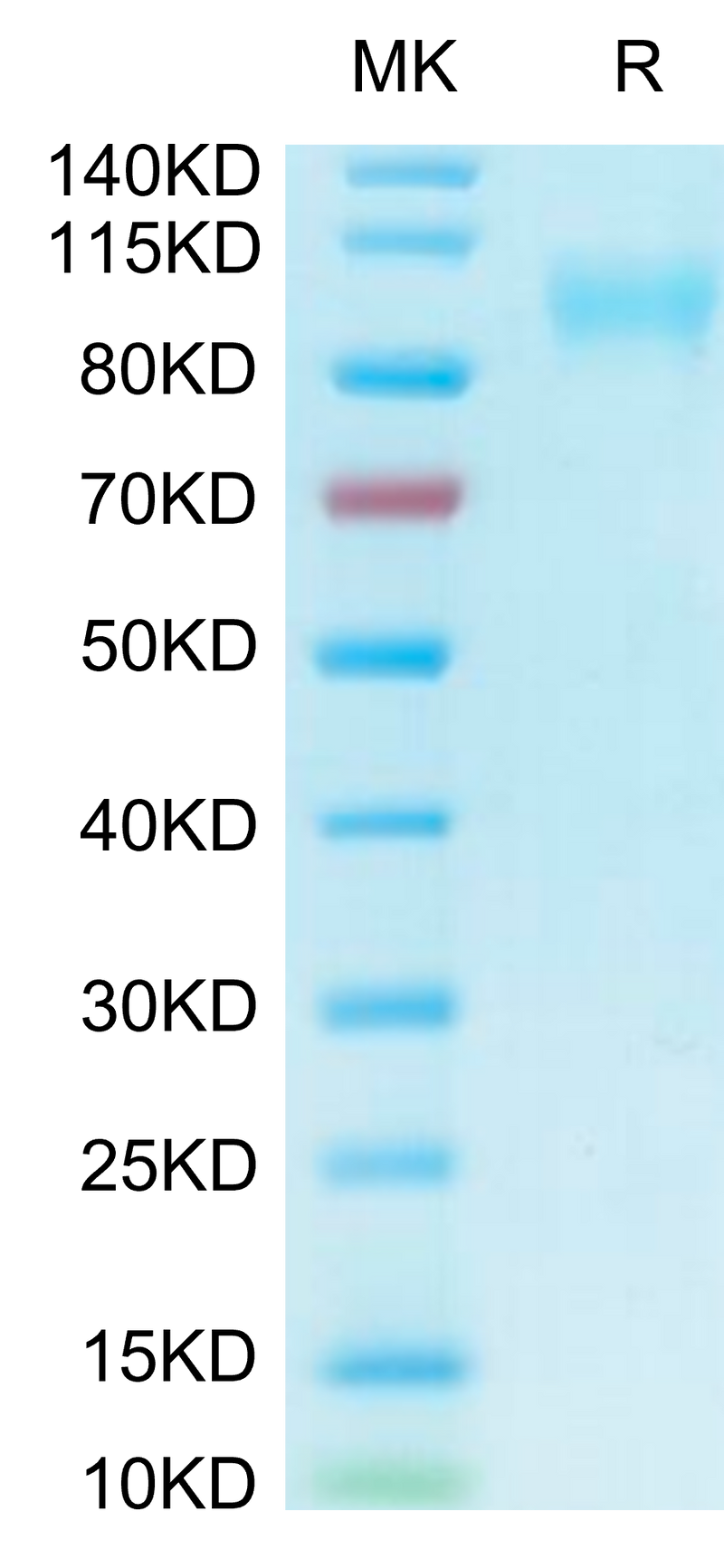 Biotinylated Human ACE2 on Tris-Bis PAGE under reduced condition. The purity is greater than 95%.